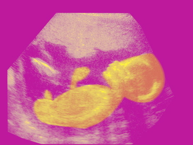 Mom demands answers on unborn child's remains