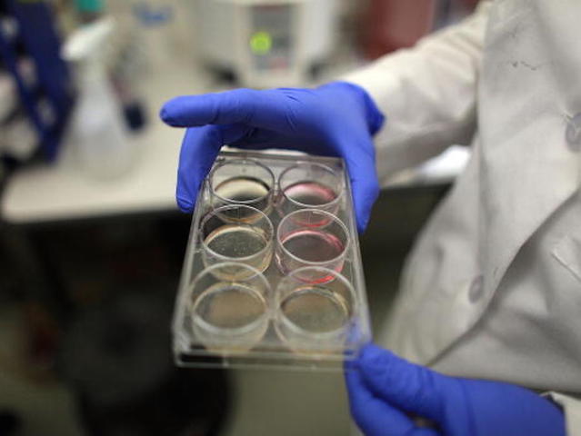 Study: Ohio's abortion pill law led to worse health outcomes