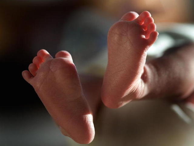 Humiliated by potty training photos, woman sues parents