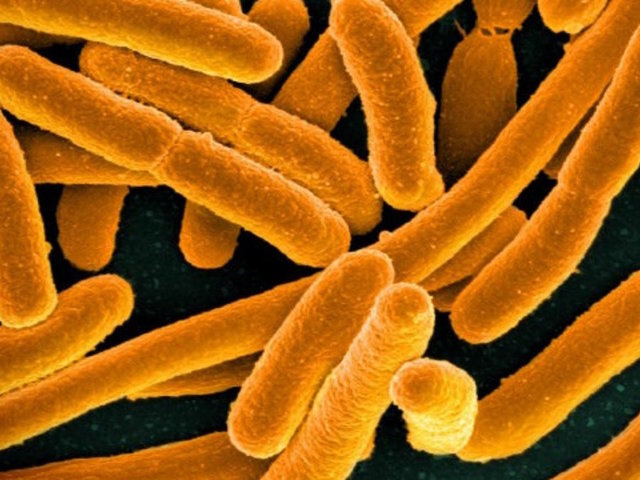 400,000 pounds of veal recalled for E. coli outbreak