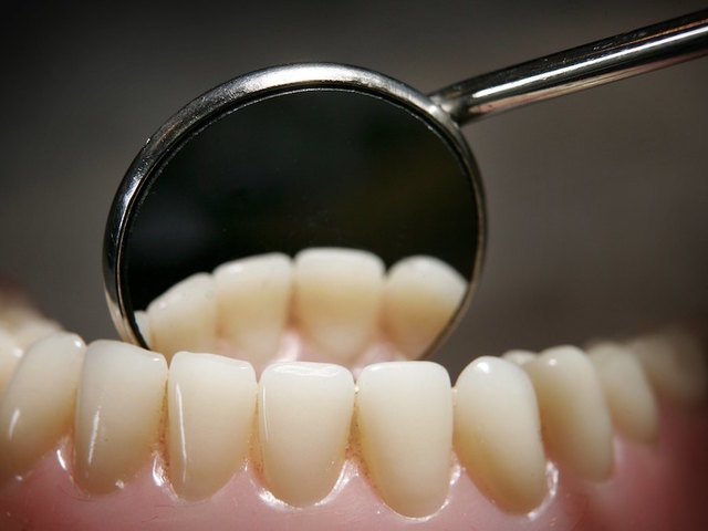 Long-term breastfeeding leads to more cavities, study says