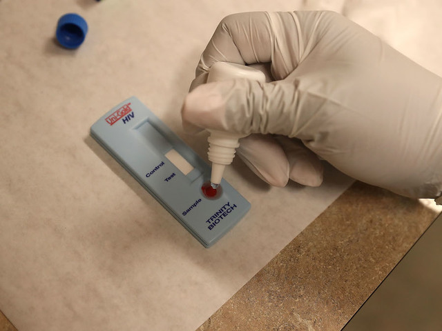 Rare case of 9-year-old in HIV remission for years -- without drugs