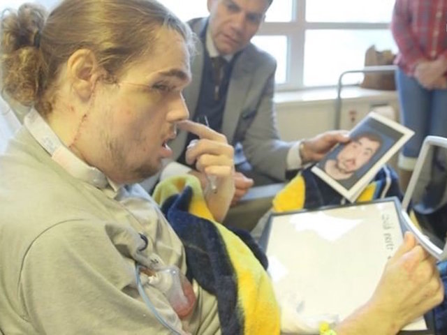 Face transplant recipient shares his new reflection with the world